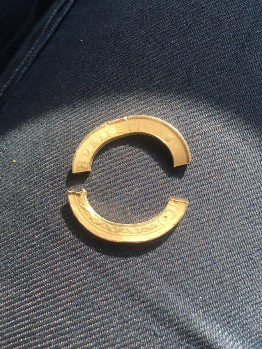 Aydın'da madeni paradan yapılan yüzük hastanelik etti