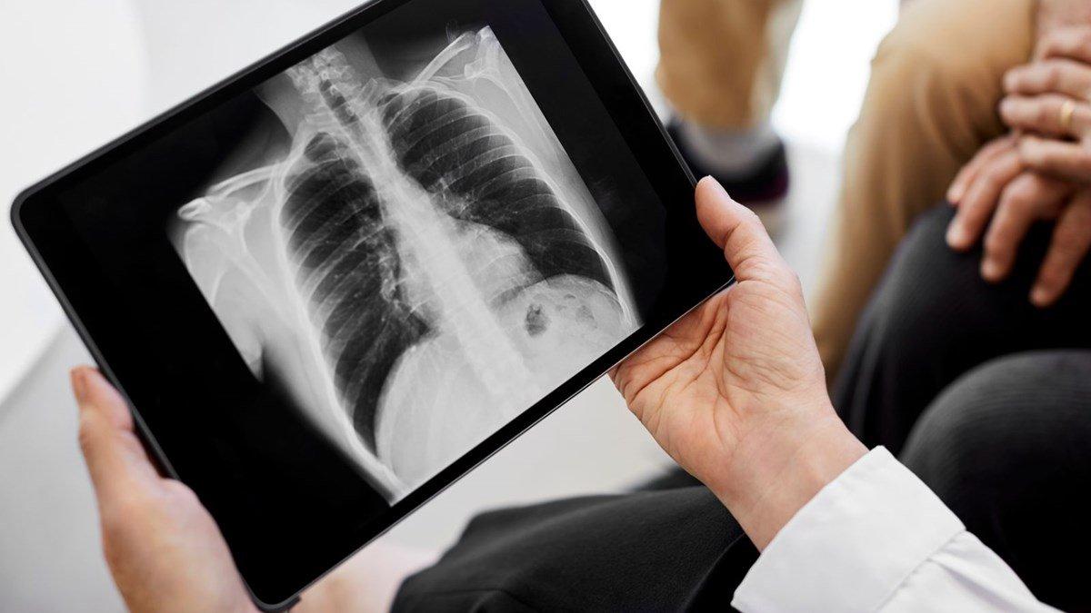 Koronavirüs sonrası görülebilen 11 semptom