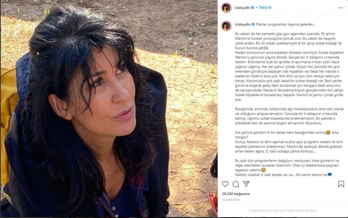 Oyuncu İclal Aydın, sokak köpeklerinin saldırısına uğradı