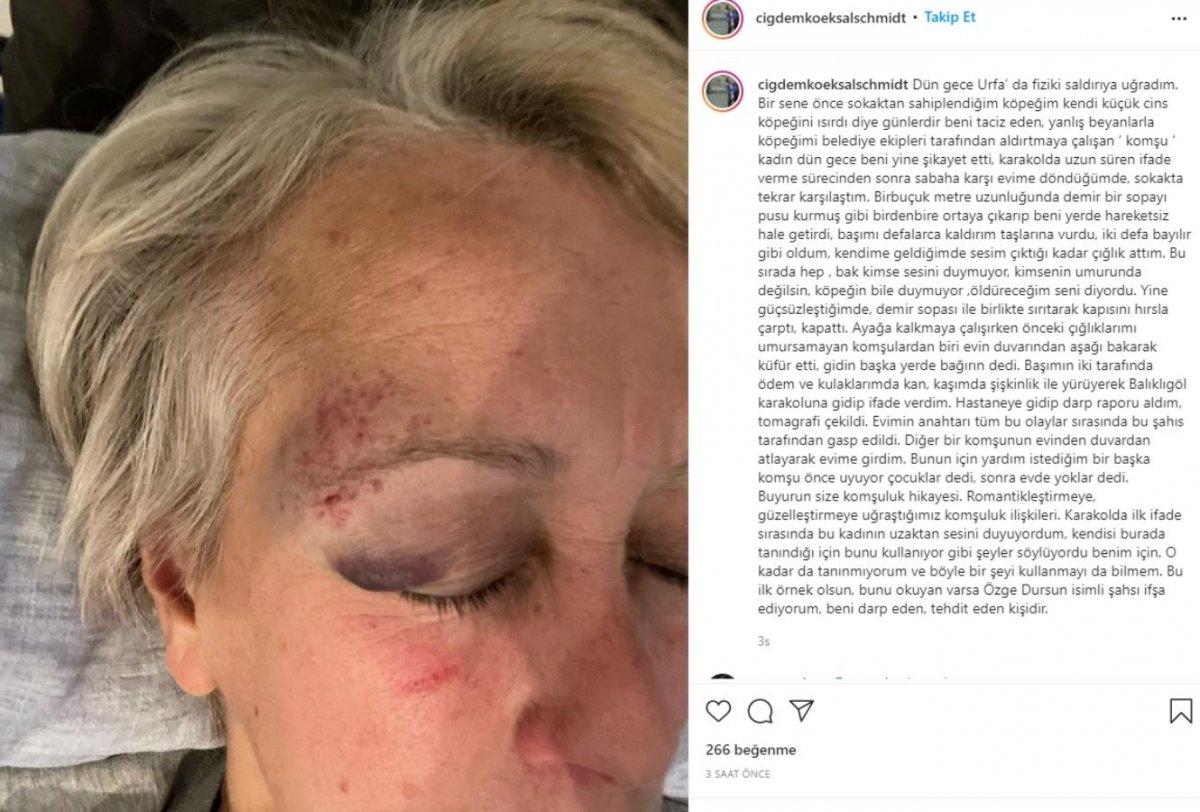 Şanlıurfa’da Alman arkeoloğun eşi demirle dövüldü