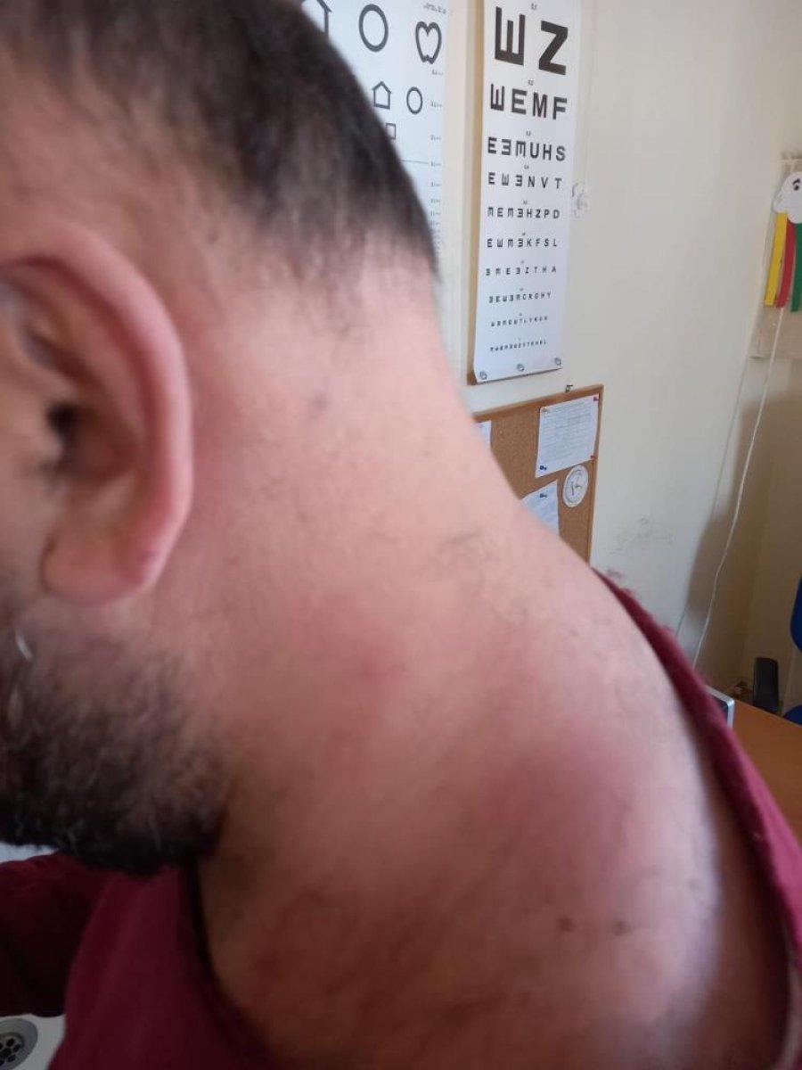 Kayseri'de aile hekimi odasında darbedildi