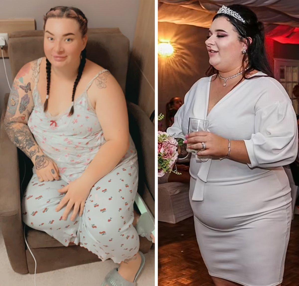 İngiltere vatandaşı, Türkiye'de geçirdiği operasyonlarla ülkesinde gündem oldu