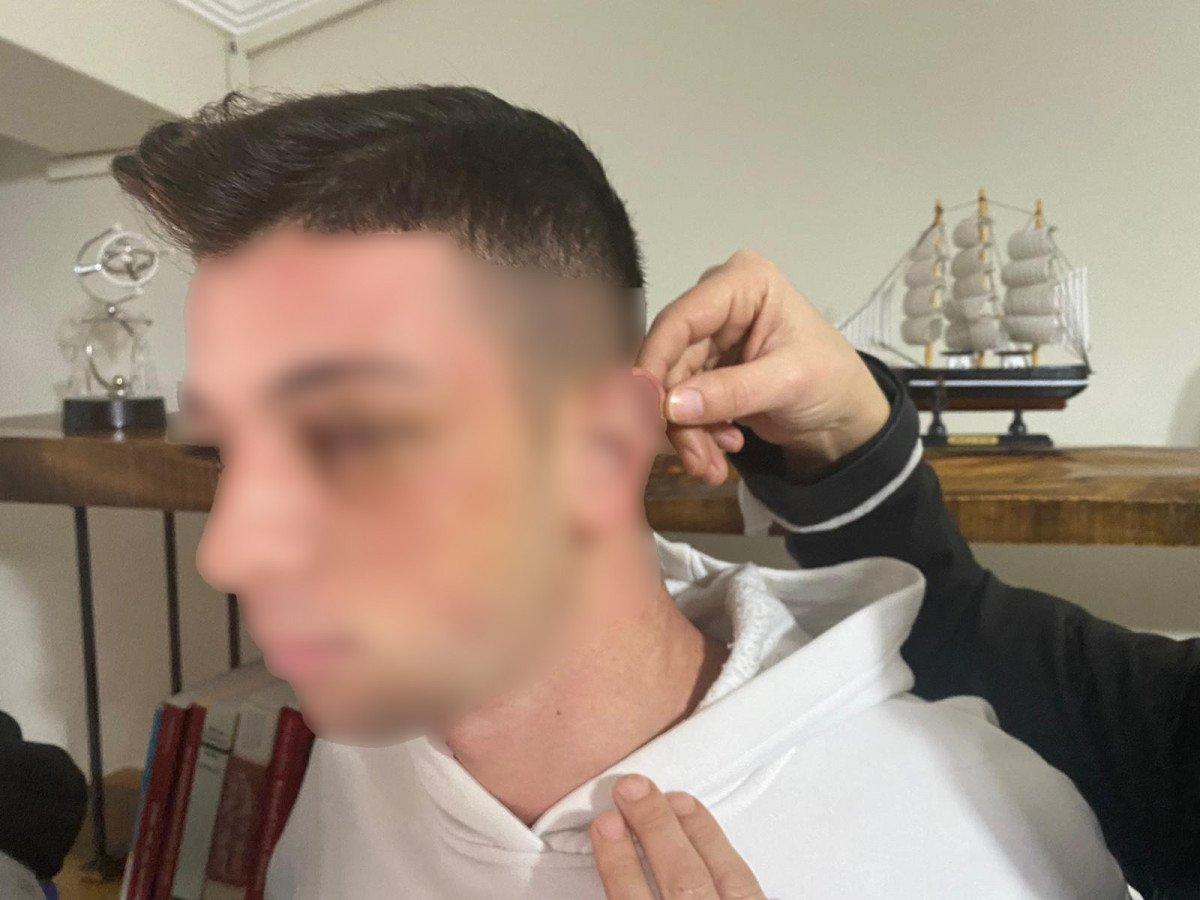 Yalova'da lise öğrencilerinin dayak iddiası