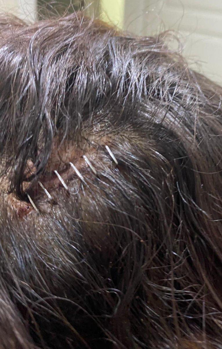 Yalova'da lise öğrencilerinin dayak iddiası