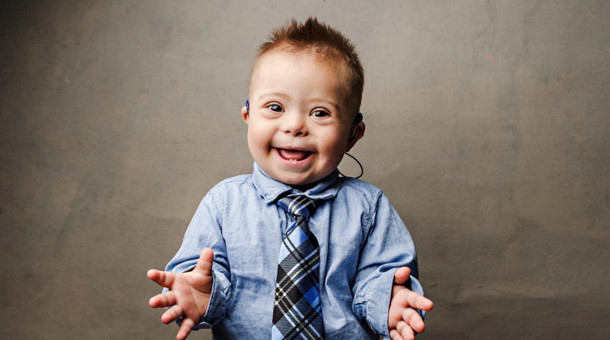 Yargıtay’dan down sendromlu çocukların ailelerini yakından ilgilendiren karar