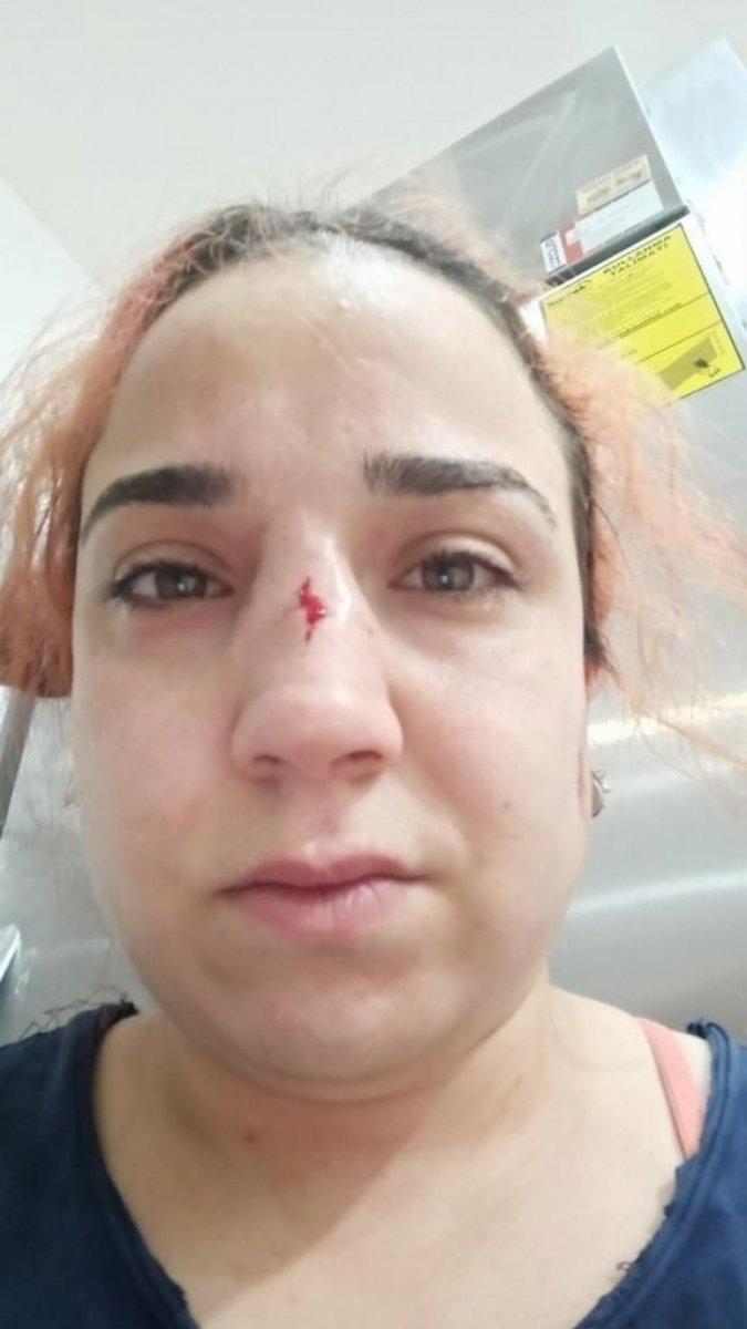 İzmir’de, işvereni tarafından burnu kırıldı
