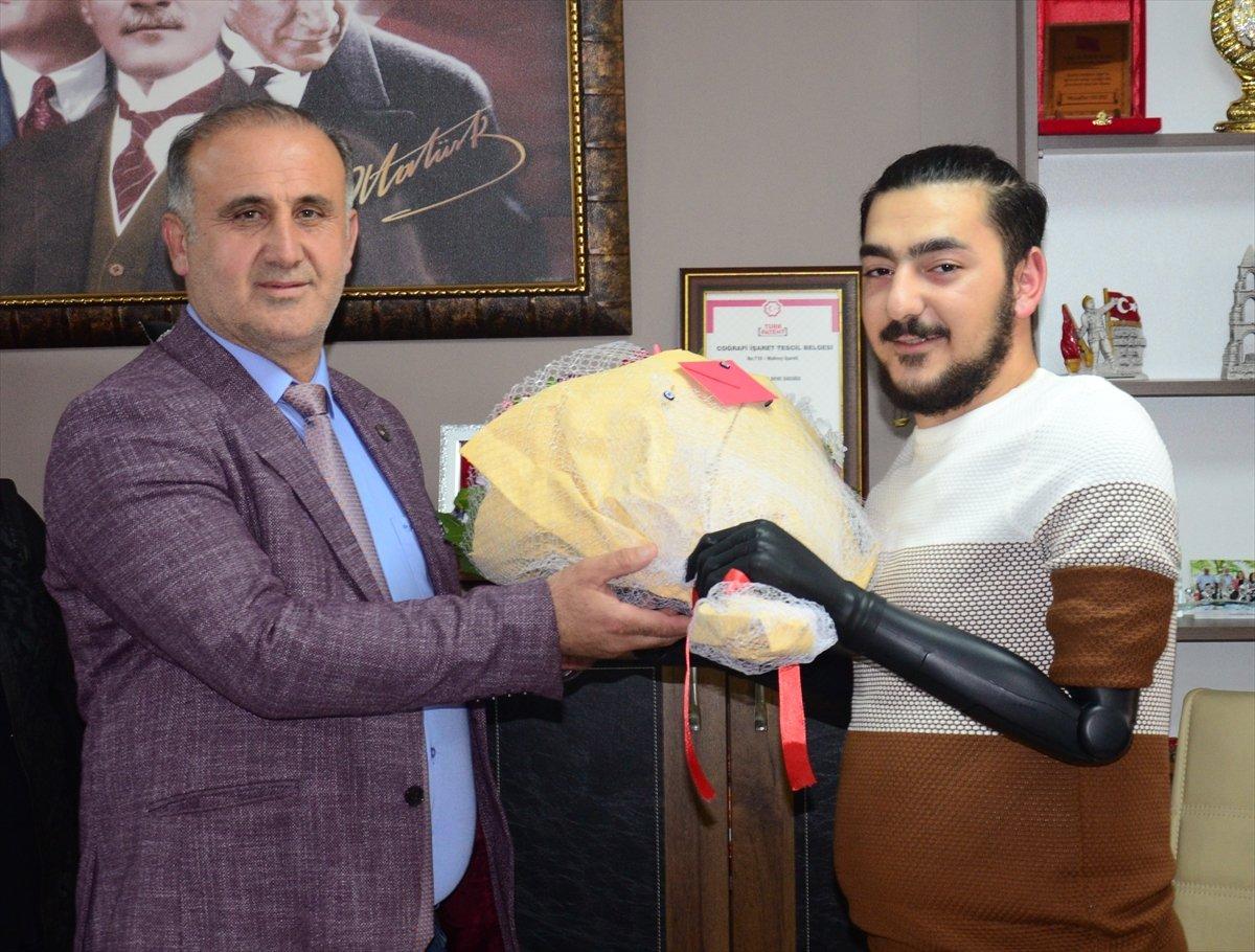 Aydın’da kollarını kaybeden genç, biyonik kollarına kavuştu
