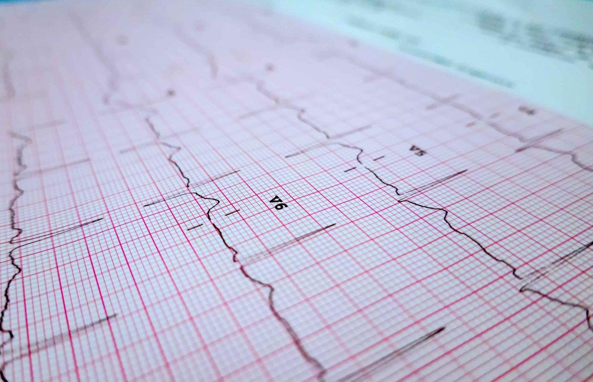 Tamamen formsuz olduğunuzu gösteren 7 belirti