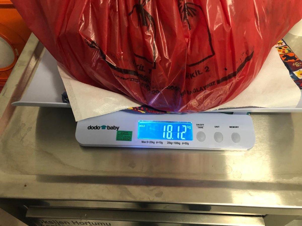 Sakarya'da karnından 18 kiloluk kitle çıktı