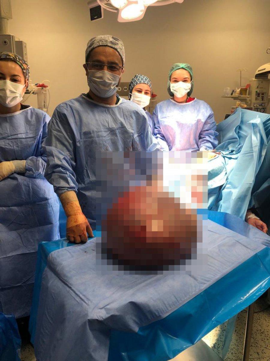 Sakarya'da karnından 18 kiloluk kitle çıktı