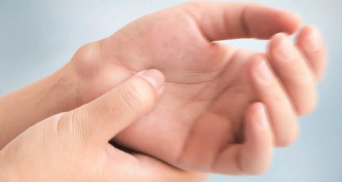 El bileğinizi kontrol edin: Ganglion kisti nedir, nasıl anlaşılır?