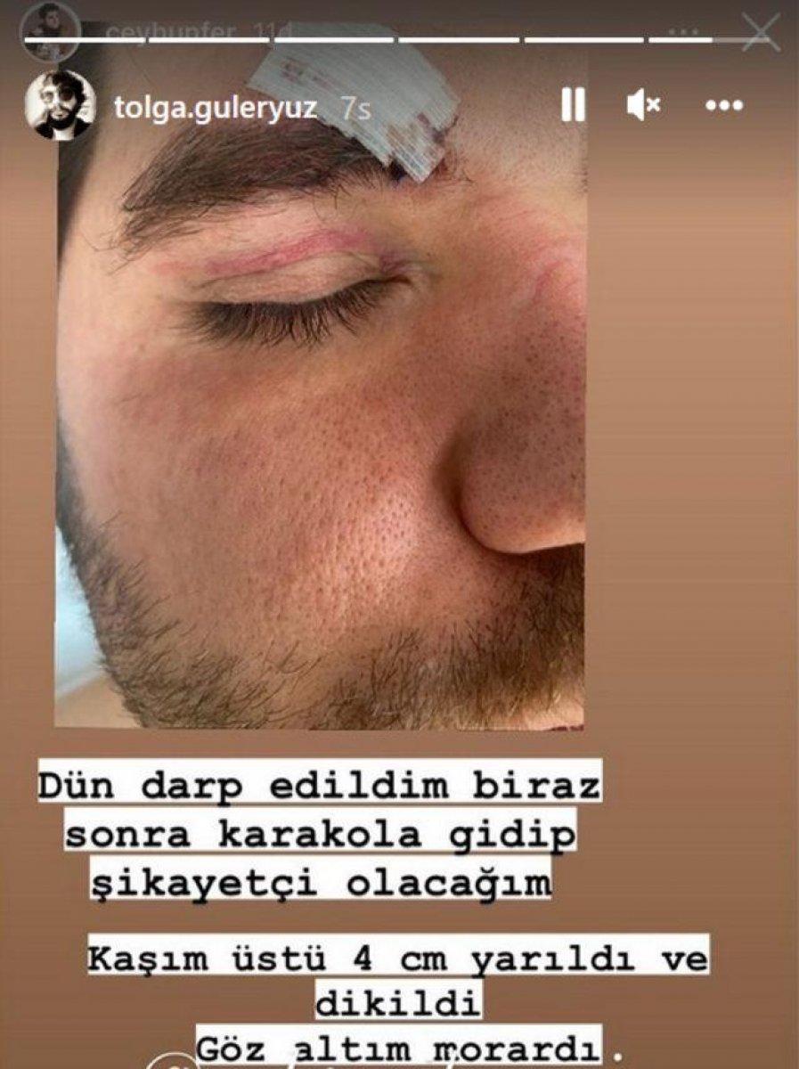 Begüm Öner darbedildikleri geceyi anlattı