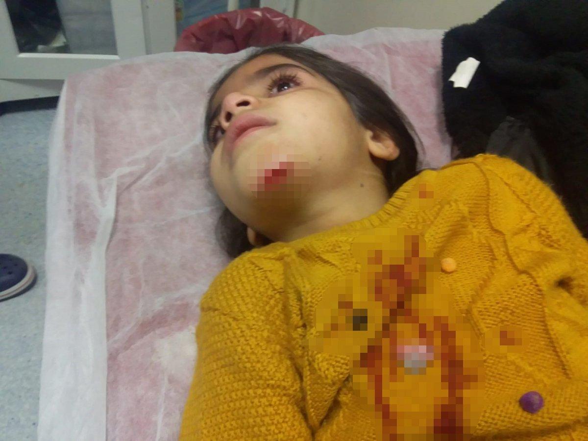 Diyarbakır'da küçük kız, belediye çukuruna düştü