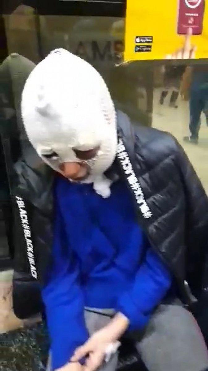 Hatay'da eski sözlüsü tarafından darbedilip, başından aşağı kızgın yağ döküldü