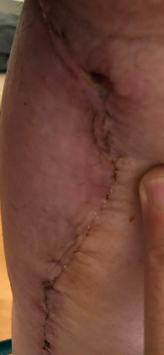 İzmir’de 3 kez bıçak altına yatan kadın, estetik mağduru oldu