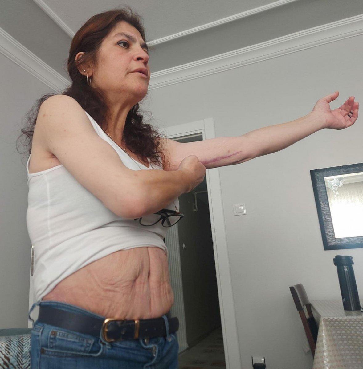 İzmir’de 3 kez bıçak altına yatan kadın, estetik mağduru oldu