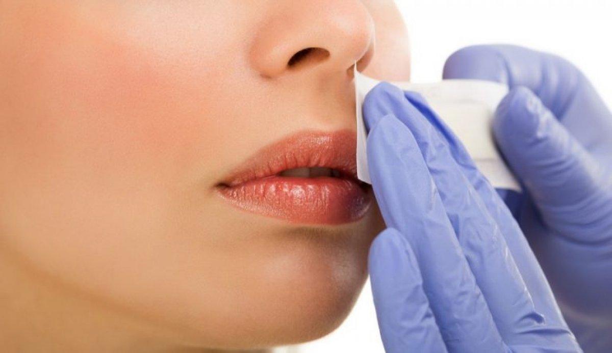 Bıyık bölgesi kararmalarına etkili çözüm...