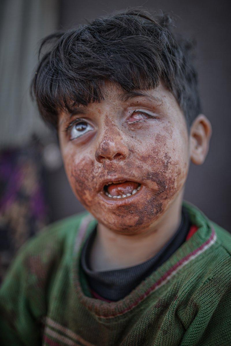 Zorlu şartlarda yaşayan Suriyeli sığınmacılar görüntülendi