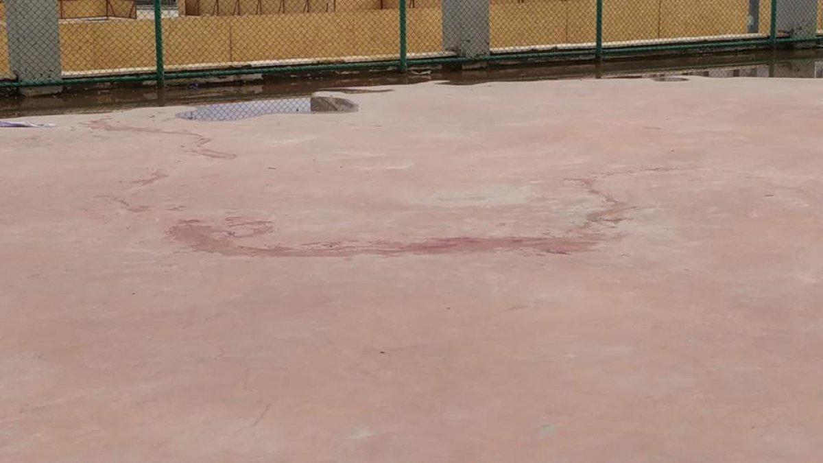 Gaziantep'te iki pitbull 4 yaşındaki kıza saldırdı