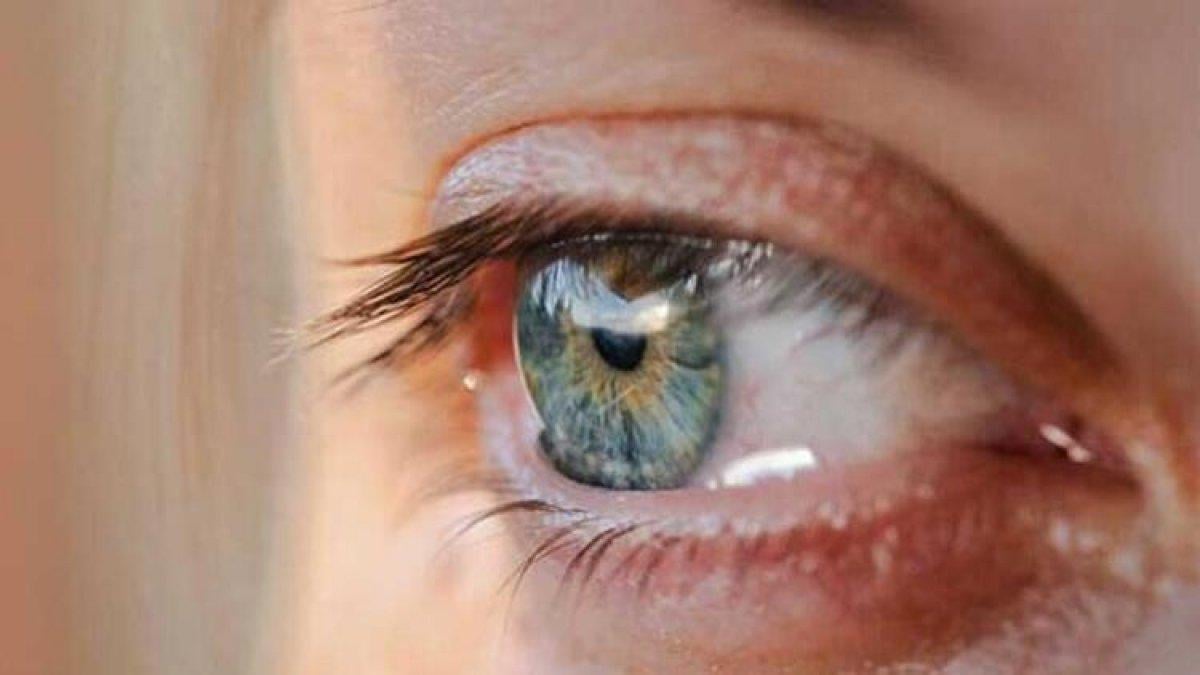 Vitamin eksikliklerinin gözle görülen 8 belirtisi