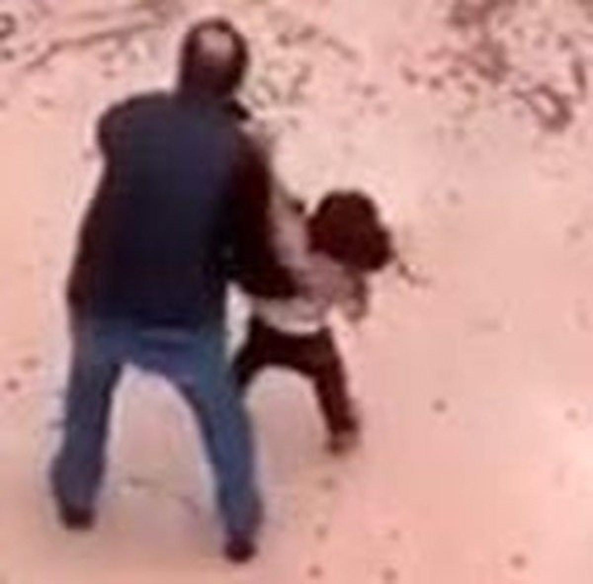 Gaziantep'te pitbull saldırısına uğrayan Asiye'nin doktoru konuştu