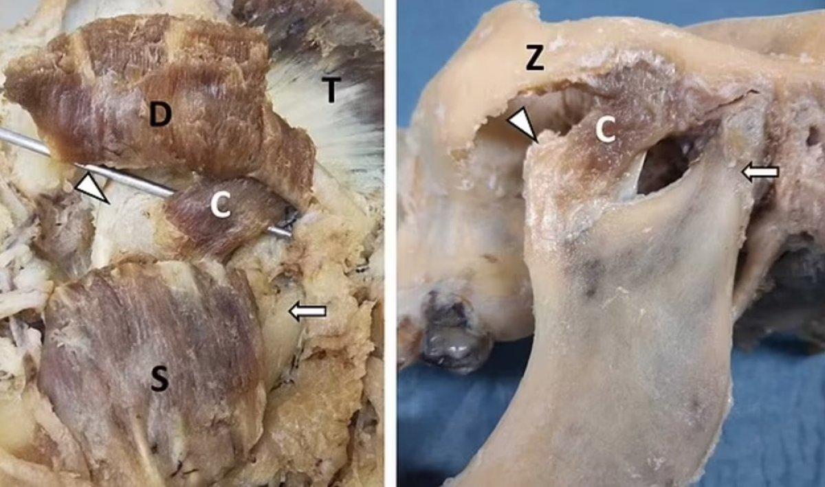 Daha önce kimse fark etmemiş! İnsan vücudunda yeni bir parça daha keşfedildi