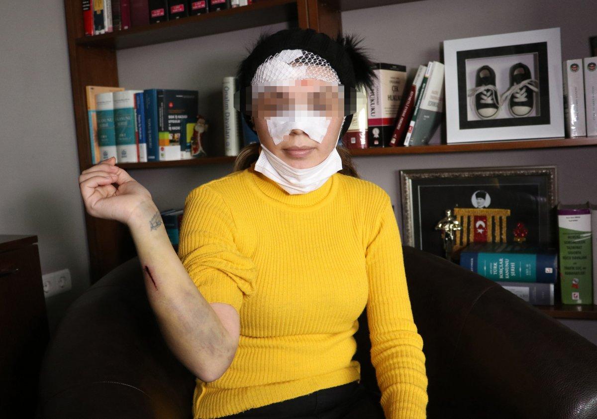 Adana'da eşi tarafından yüzü bıçakla kesilen kadın konuştu