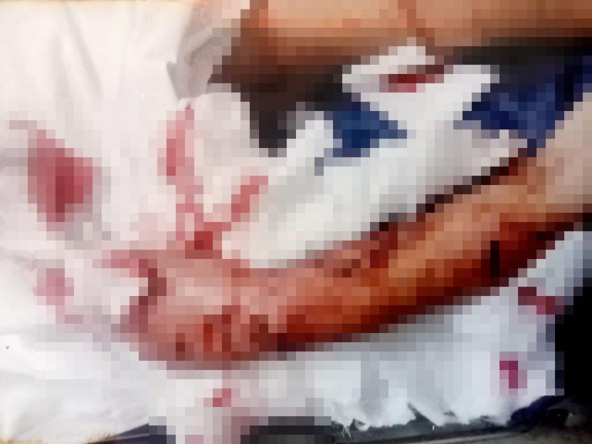 İzmir'de pitbullun saldırdığı çocuk, 4 yıldır psikolojik destek alıyor