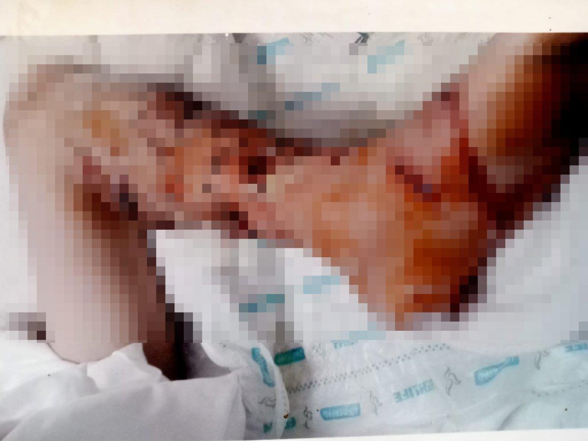 İzmir'de pitbullun saldırdığı çocuk, 4 yıldır psikolojik destek alıyor