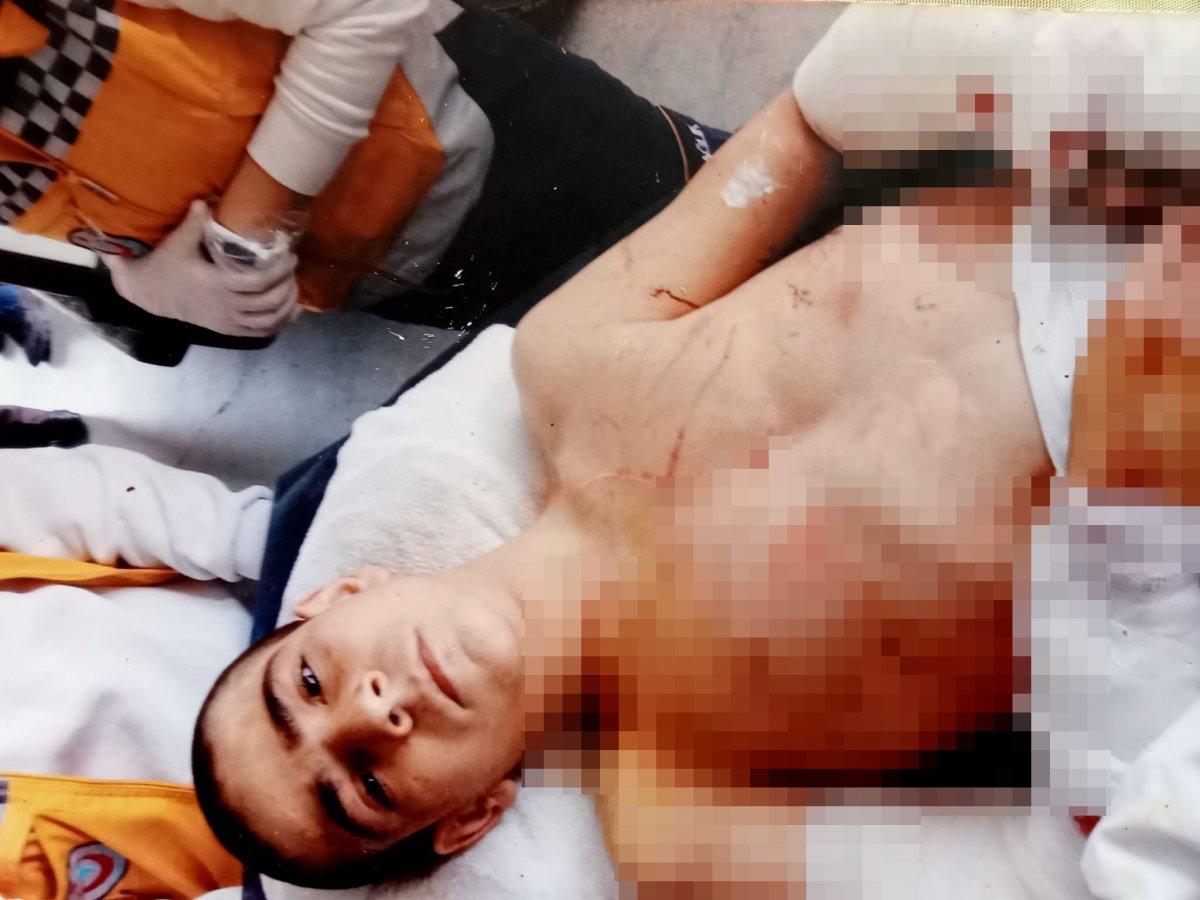 İzmir'de pitbullun saldırdığı çocuk, 4 yıldır psikolojik destek alıyor