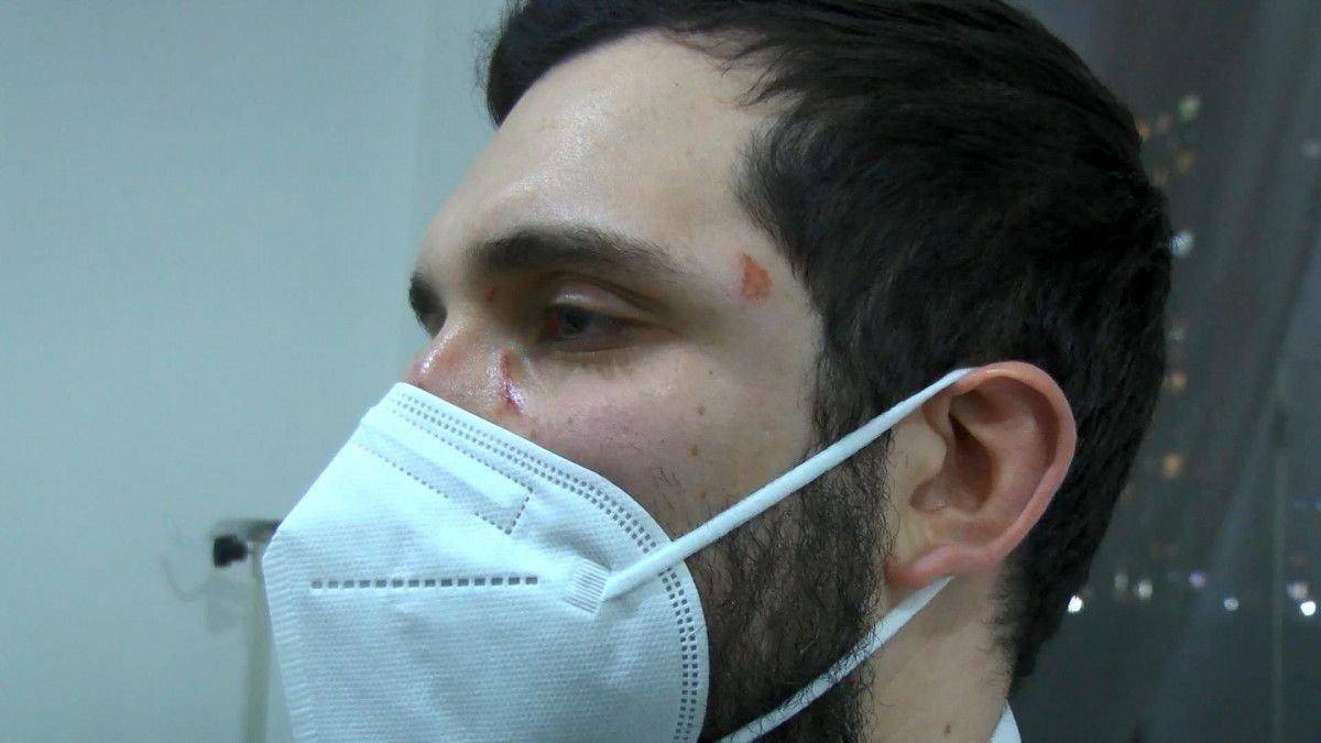 Avcılar’da doktora yumruk atan şüpheli tutuklandı