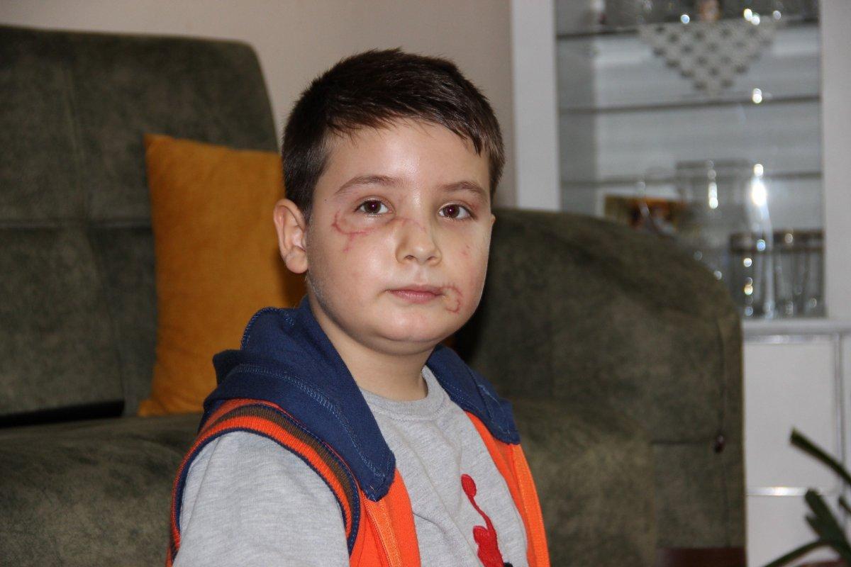 Manisa'da köpek saldırısına uğrayan Mert, travma yaşıyor