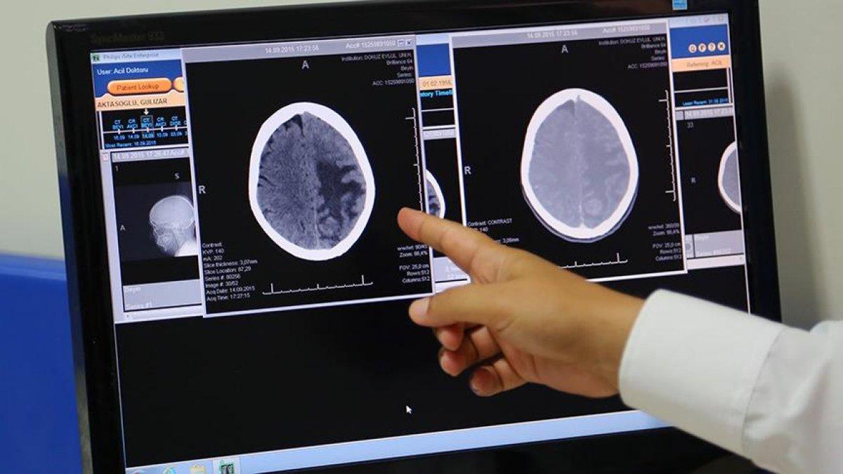 Türk doktordan damar tıkanıklığını gidermede yeni yöntem