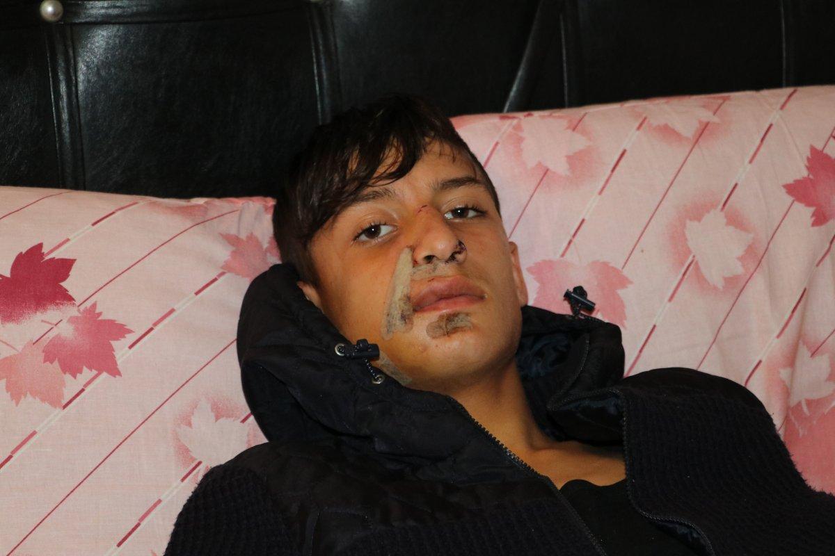 Adana'da 16 yaşındaki genç, tırın altında kaldı