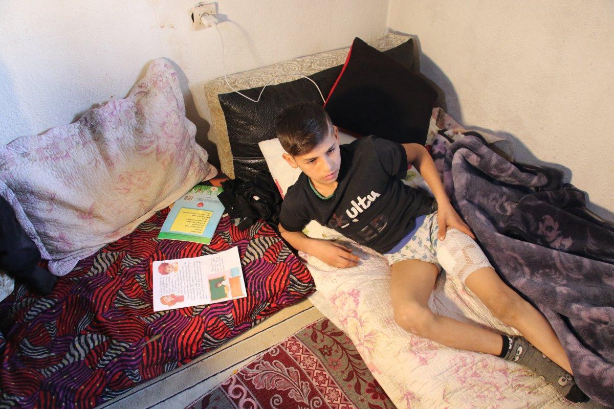 Ankara'da köpeğin saldırdığı çocuk: Bacağımdan et kopardılar