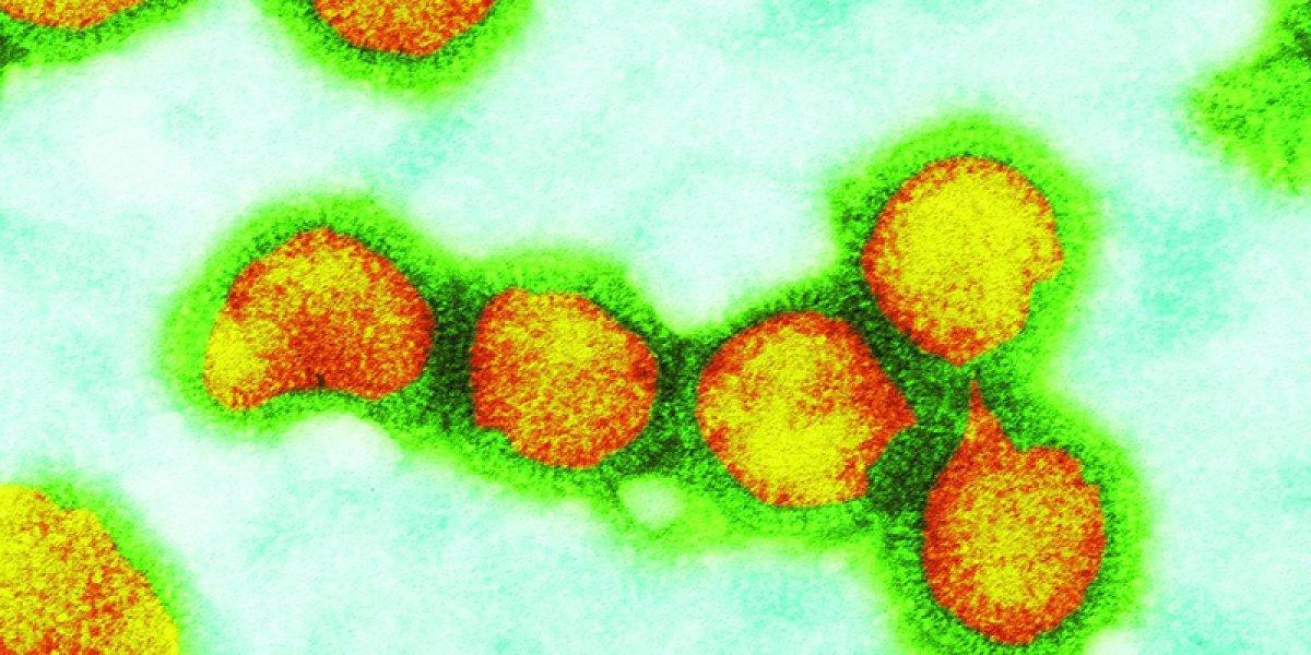 Hem grip, hem korona! İlk 'Flurona' vakası görüldü: İşte belirtileri...