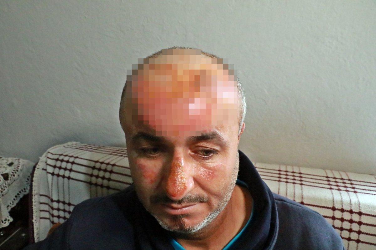 Antalya'da yangında her şeylerini kaybeden ailenin yüzü, yapılan yardımlarla güldü