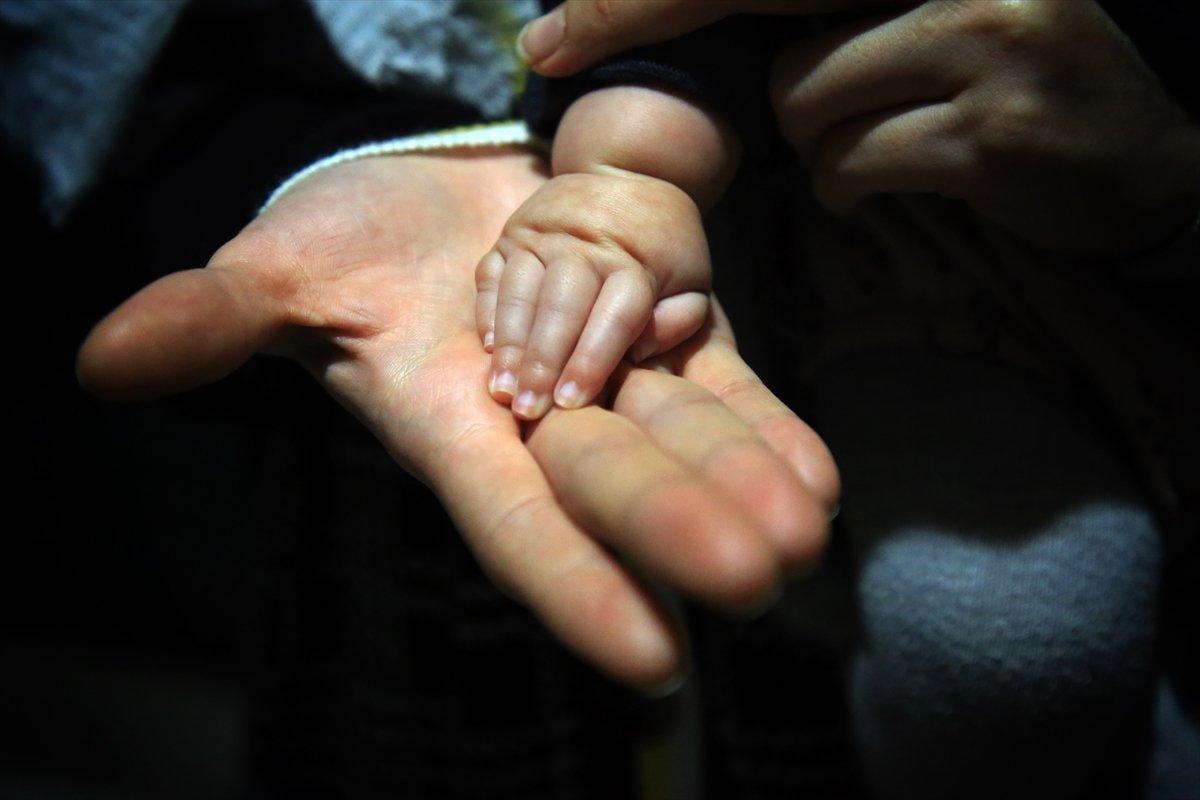 Mersin'de Elif bebek, anne karnındaki operasyonla hayata tutundu