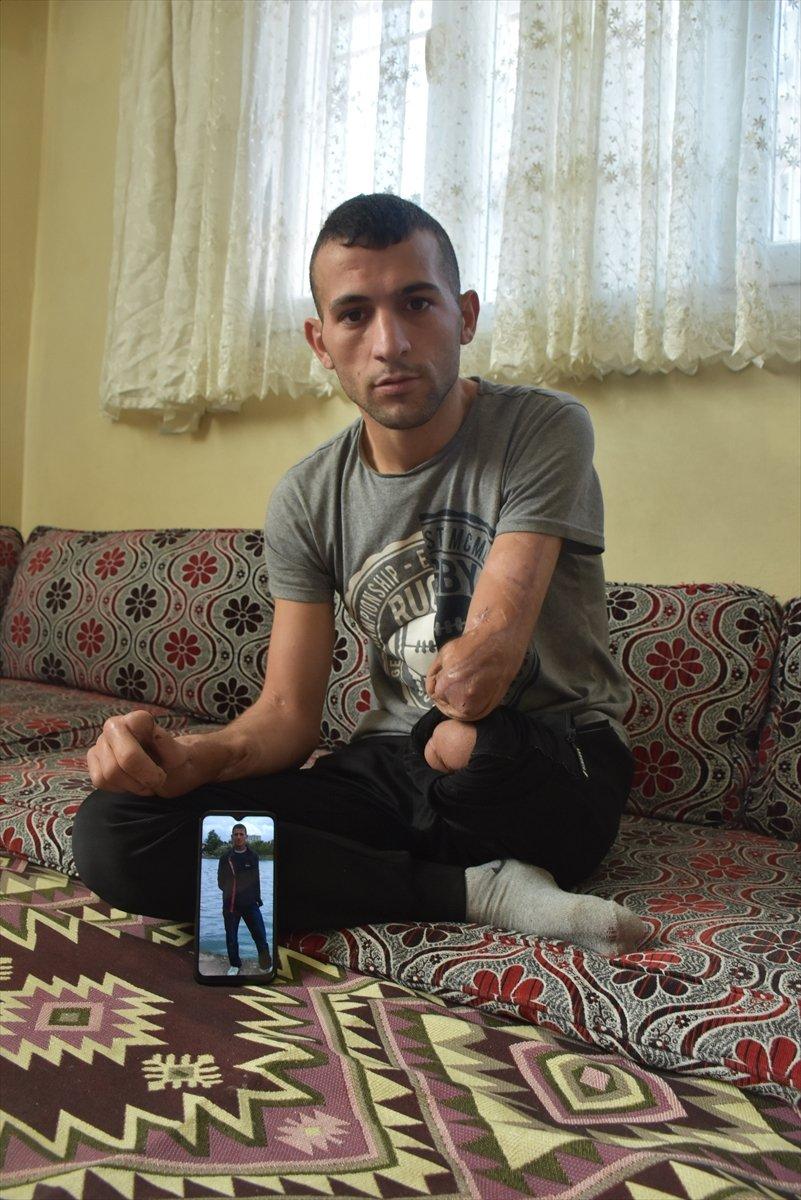 Adanalı genç, protez desteği bekliyor