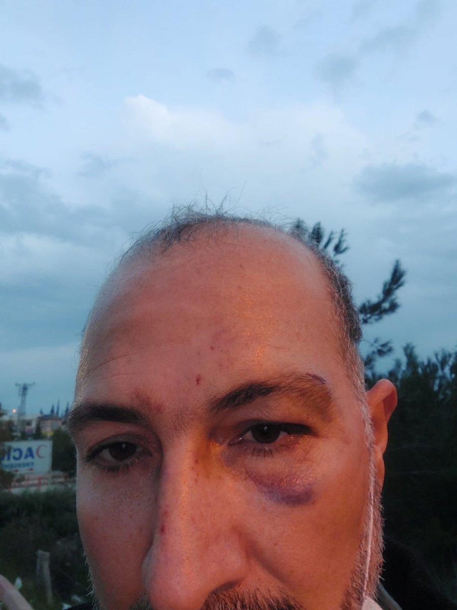 Adana’da veteriner hekime darp şüphelisi: İlk o vurdu