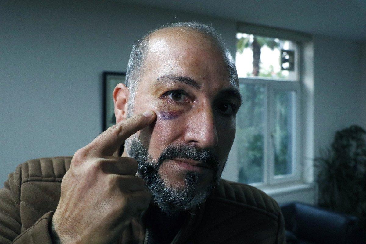 Adana’da veteriner hekime darp şüphelisi: İlk o vurdu