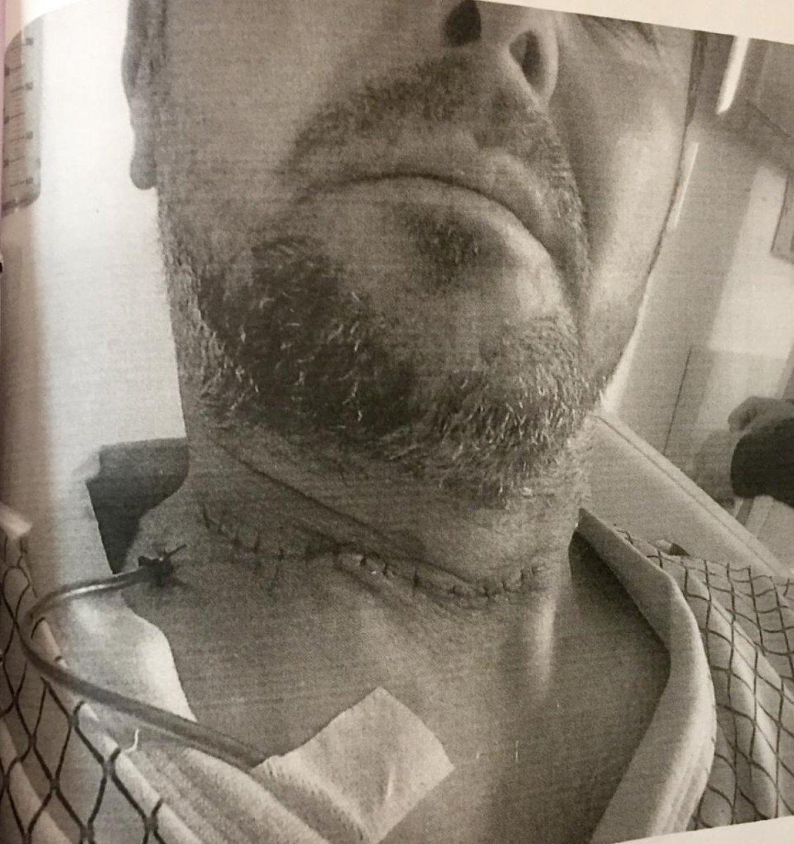 Ankara'da arkadaşının boğazını kesti: İstenen ceza belli oldu