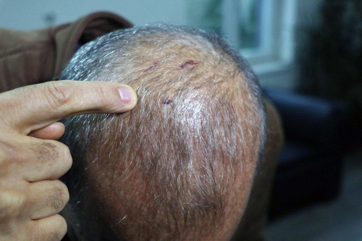 Adana’da veteriner hekime darp şüphelisi: İlk o vurdu