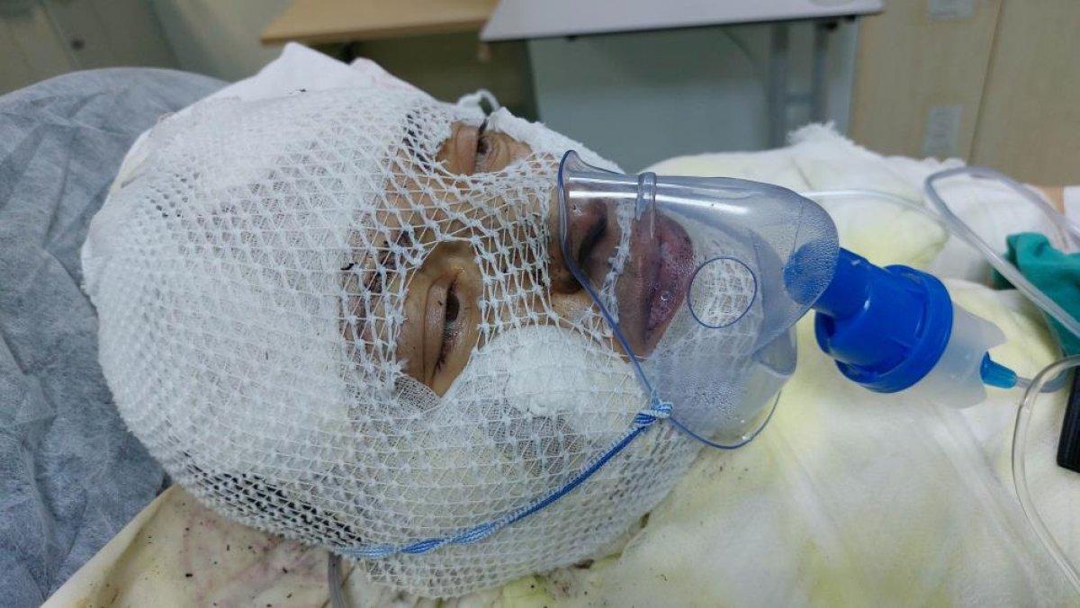 Ordu'da cani adam eski eşini yaktı