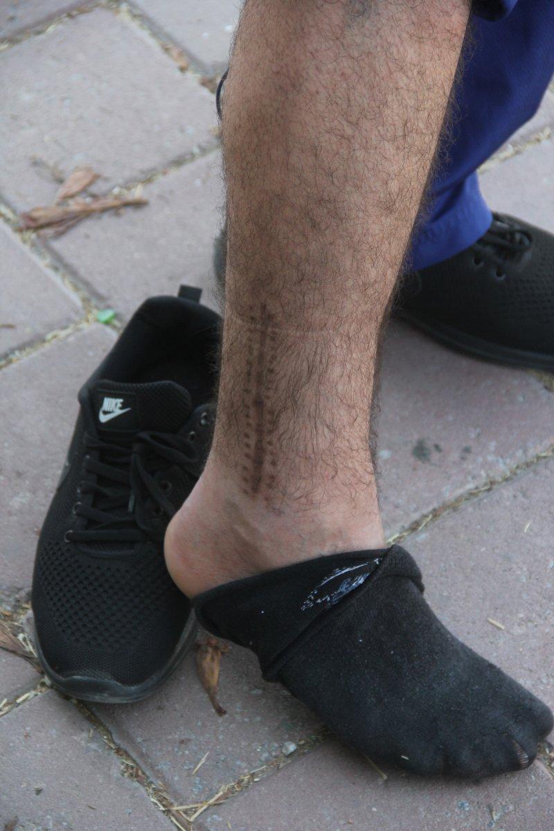 Adana'da hem ayağından hem işinden oldu, 45 bin TL tazminat aldı