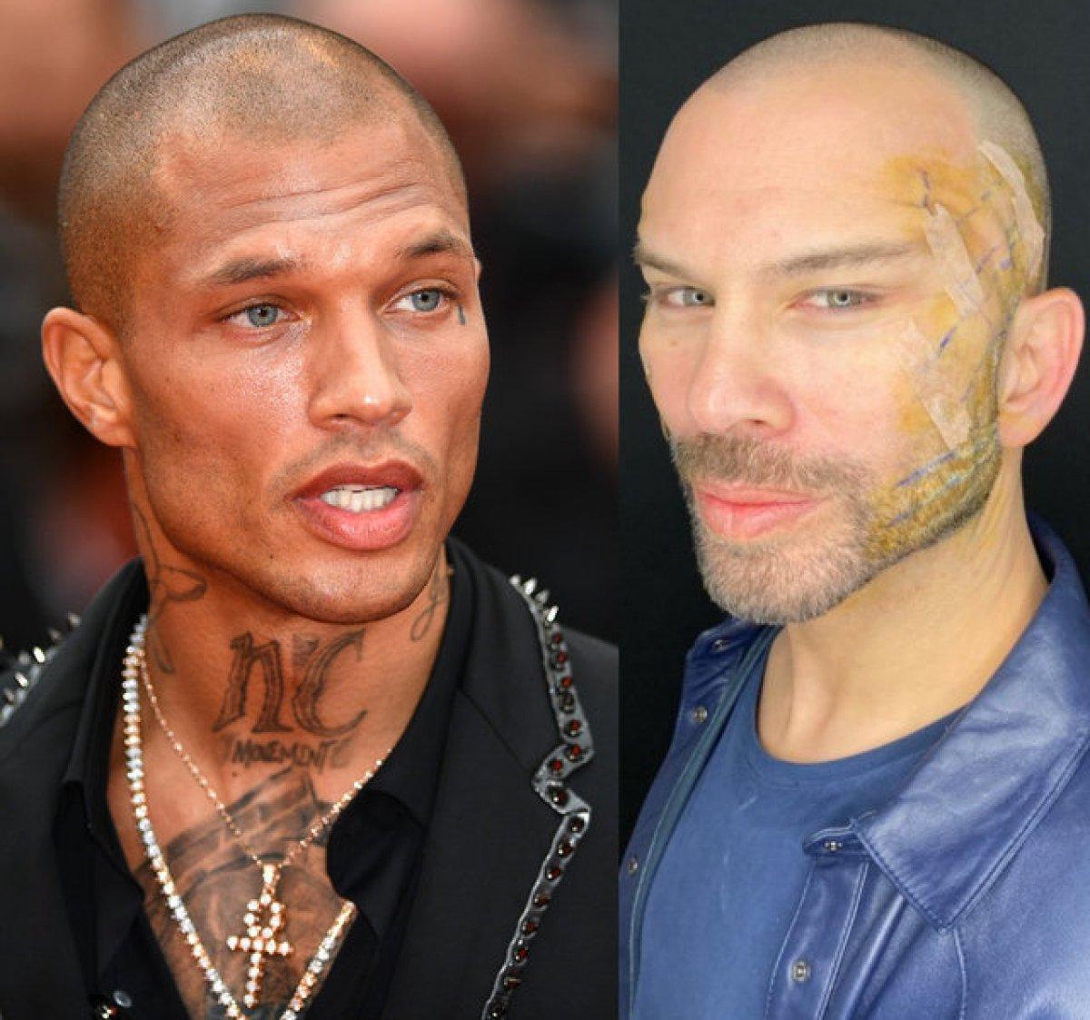 Fransız askısı yaptıran Berksan: Estetik erkek adamı bozmaz