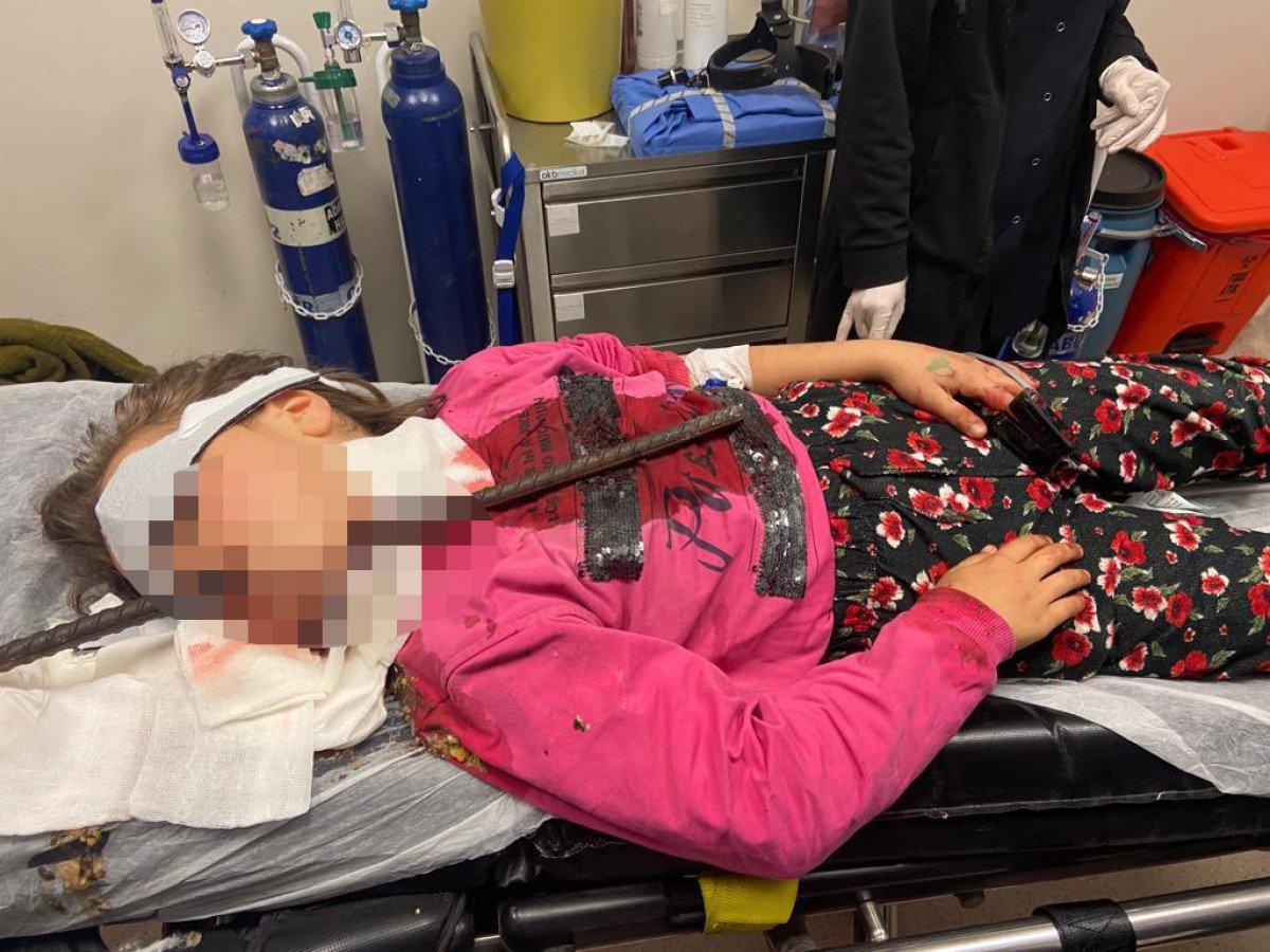 Adana’da boğazına demir çubuk saplanan kız çocuğu kurtuldu