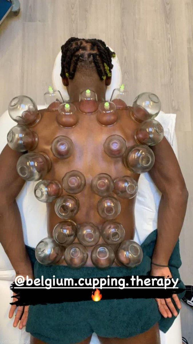 Michy Batshuayi hacamat yaptırdı