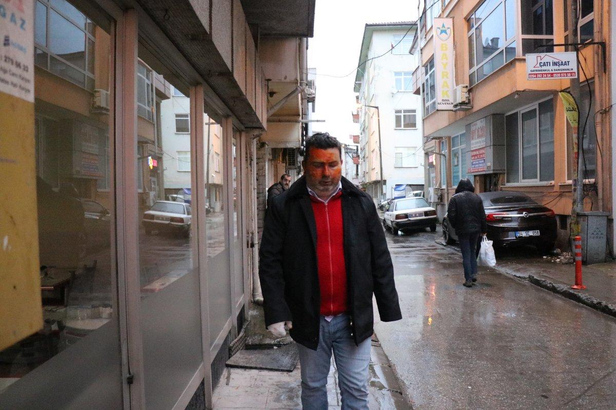 Sakarya'da, uykudayken yüzüne yanıcı madde döküldü