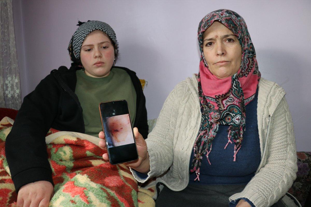 Van'da köpek dehşeti: Genç kızın bacağı parçalandı